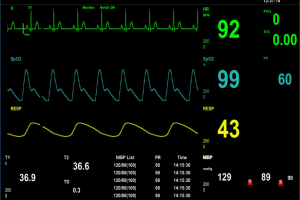 Health Monitering system - IoT & AI development
