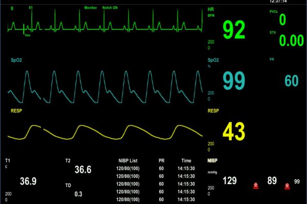 Health Monitering system - IoT & AI development