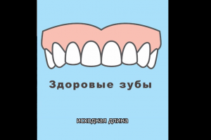 Создание вертикальных роликов для инстаграм по тематике стамотологияс нейросетями
