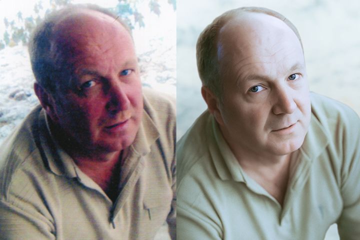 Уберу красноту, покраснения, красные капиляры, пятна, красные глаза - 5589497