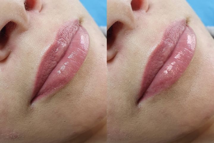 Ретушь фотографий - 5601209