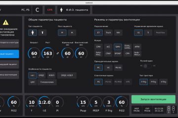 Аппарат ИВЛ (дисплейная часть)