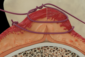 Медицинская визуализация/Анатомические изображения для стоматологов