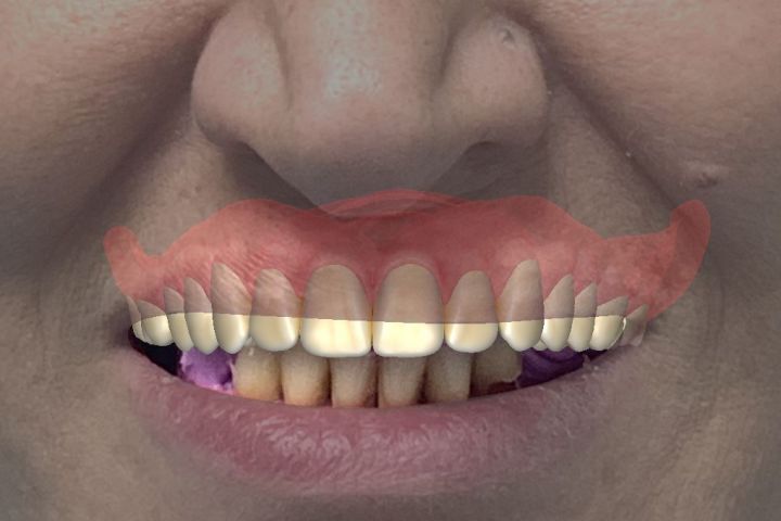 3 д моделирование в  экзокад,exocad, CAD design - 5688648