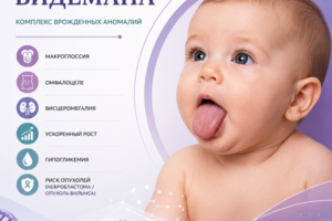 СИНДРОМ БЕКВИТА–ВИДЕМАНА