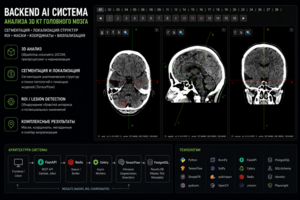 AI/CV система для анализа 3D КТ головного мозга