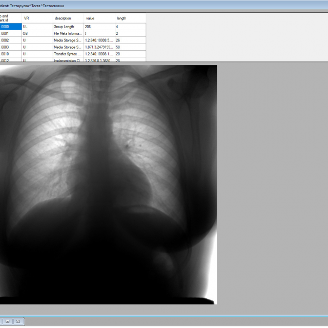 DICOM Viewer