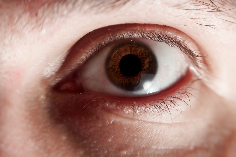 Спазм глаз. Парез и паралич аккомодации. Спазм аккомодации схема. Спазм зрачков. Мидриаз и паралич аккомодации.