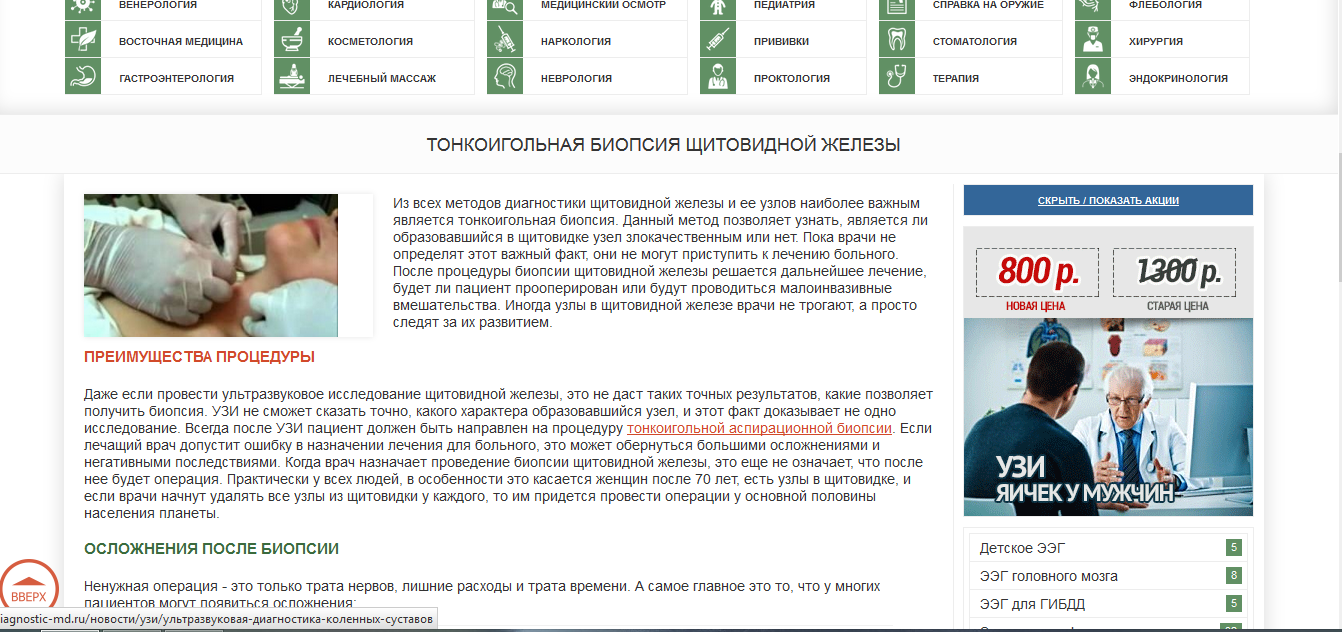 Биопсия узла щитовидной железы как проходит Тонкоигольная биопсия щитовидной железы - Фрилансер Наталия Котоман natawa777 - 