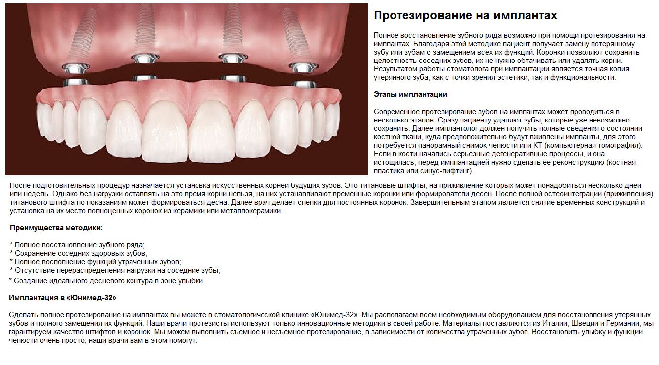 Что нельзя делать после установки. Клинические особенности протезирования на имплантатах.. Этапы имплантации зубов. Этапы постановки импланта зуба.
