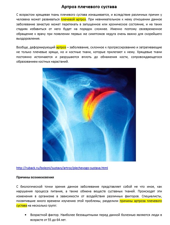 Лечение артроза плечевого сустава. Препараты от артроза плечевого сустава. Артроз плечевого сустава степени. Остеоартроза плечевого сустава. Артроз правого плечевого сустава.