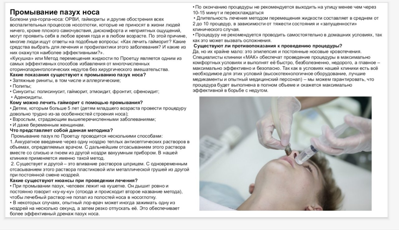 Промывание носа форум. Промывание носа Кукушка алгоритм. Промывание пазух носа методом Кукушка. Методика промывания полости носа. Промывание полости носа алгоритм.