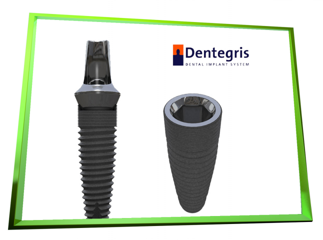 Dental Implant  