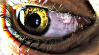 eye