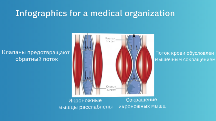 Infographics for a medical organization